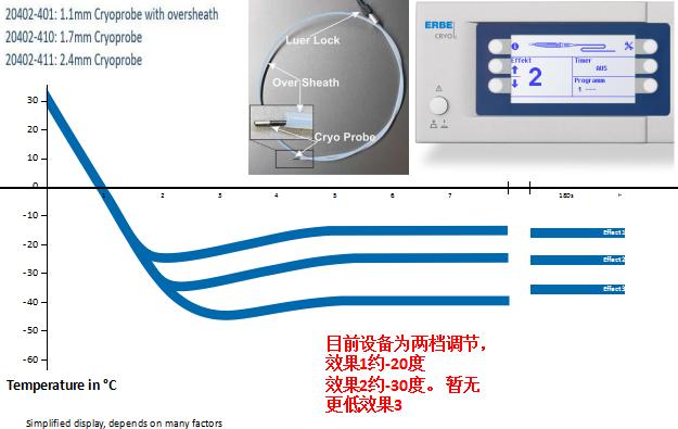 小细胞肺癌的气管镜介入治疗,导航支气管镜在肺癌诊断中的应用