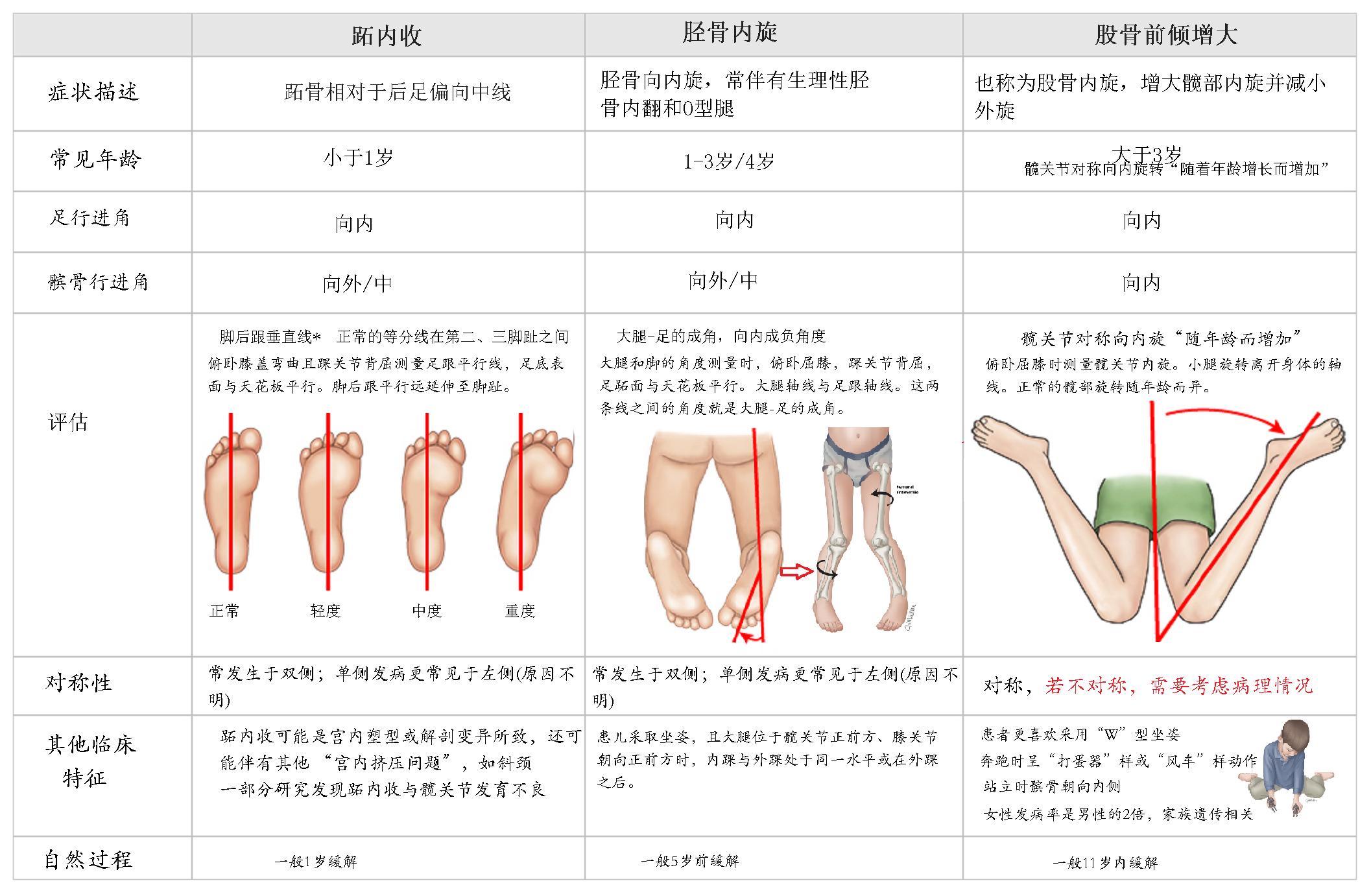 小孩子走路内八字要不要干预,婴儿走路内八字需要治疗吗