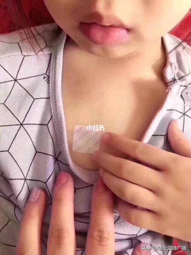 止咳神器止咳贴,止咳贴治哪种病好用