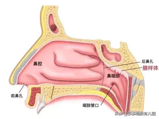 张嘴呼吸一定是腺样体肥大吗,张口呼吸一定会腺样体面容吗