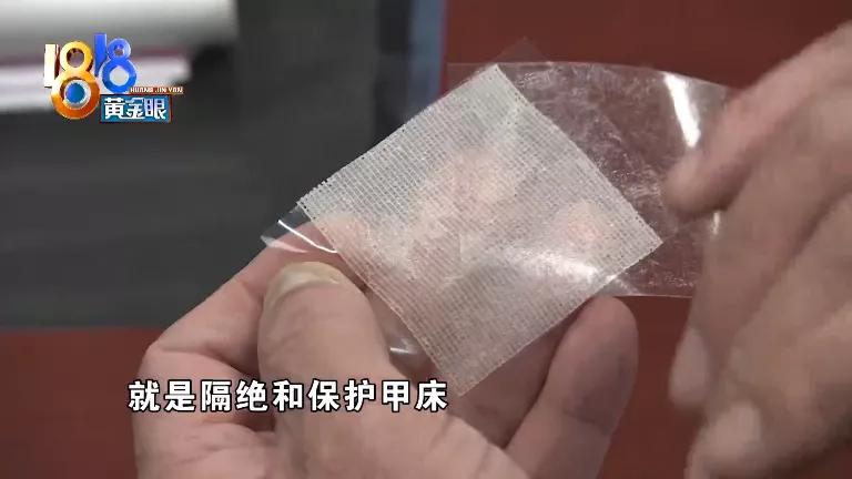 伤口拆线后多久没包纱布了,拆线后发现伤口有小白点