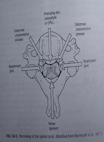 颈椎腰椎疾病ct及mri诊断,腰椎ct可以发现肠部病变吗