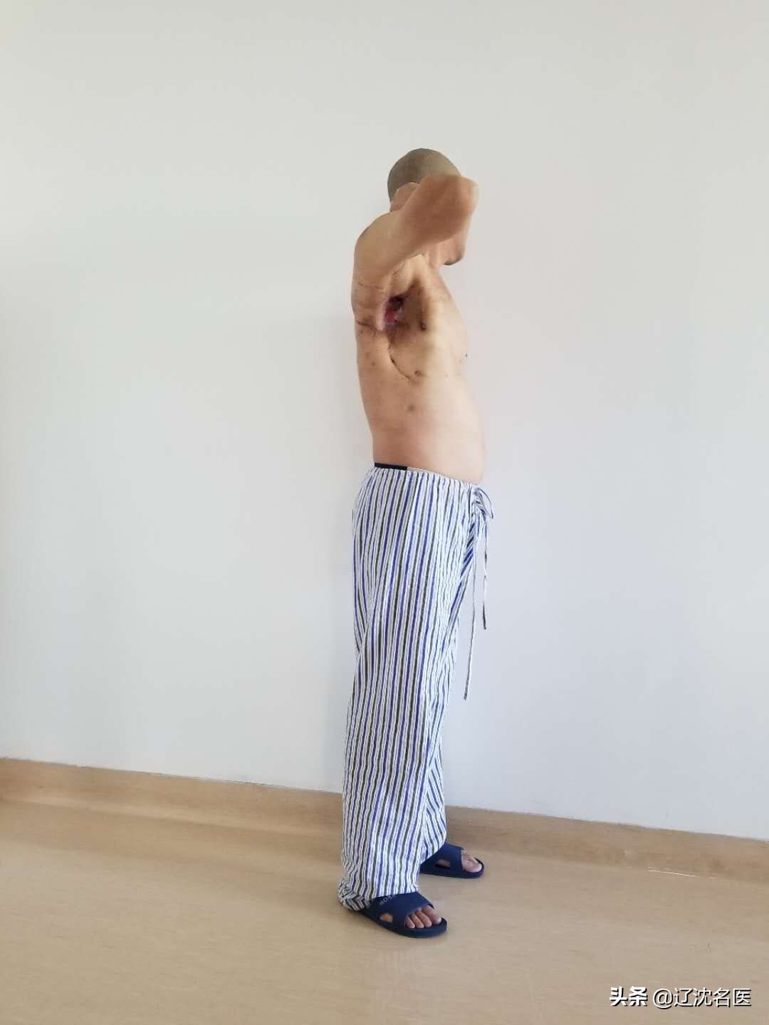 男人被病痛折磨20年,男子被病魔折磨10年