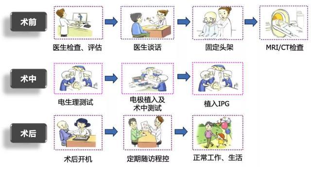 女孩行走姿势怪异,少女走路姿势怪异
