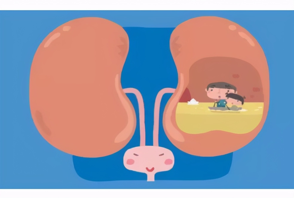 肾积水到什么情况才需要切除,ct检查不出肾积水原因