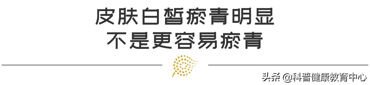 如何用红花油消退瘀青,摔伤淤青不消退是怎么回事