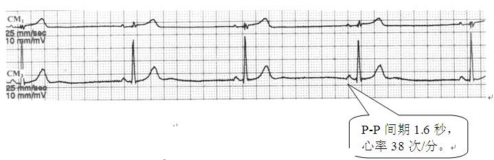 检查心脏心电图,检查心脏彩超是最好的吗