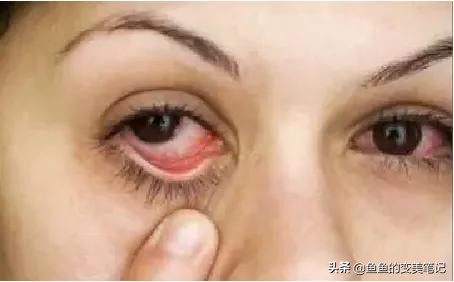 9款戴美瞳必备你准备好了吗,怎么选美瞳和护理美瞳