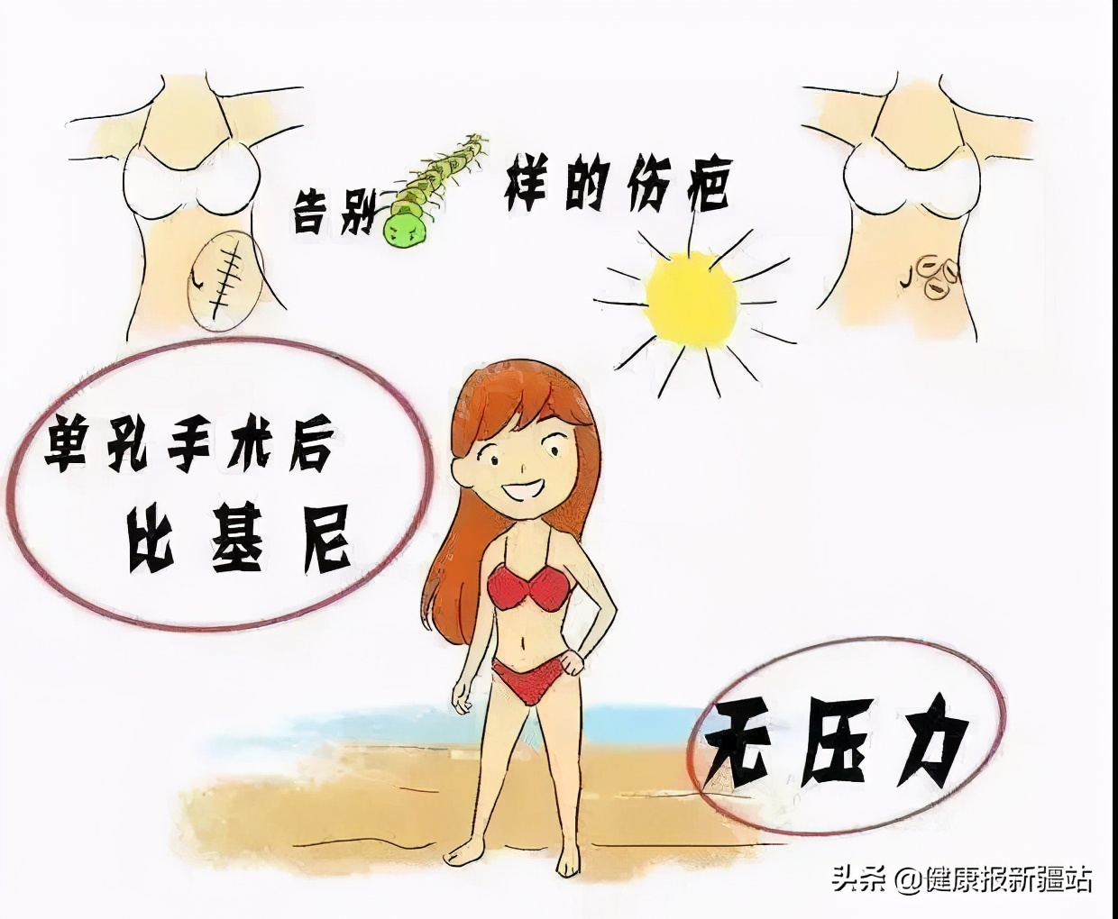 一次做了三项手术,肚子上一个“洞”也没有