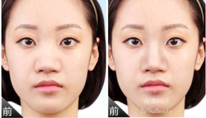 鼻梁很塌怎么画修容,塌鼻子大鼻头怎么画鼻影