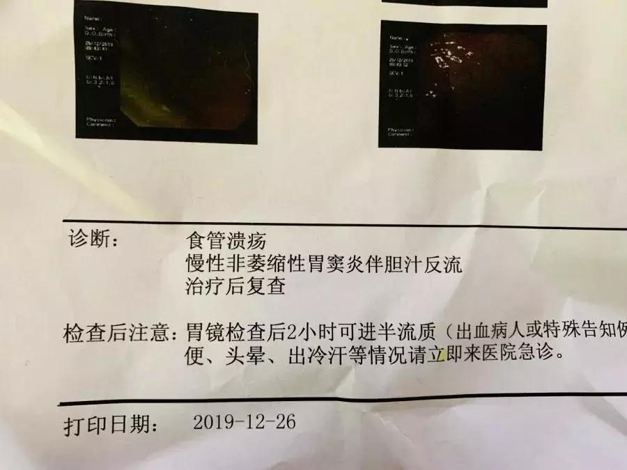 吃火锅后反胃吐血是什么原因,健康饮食之后吃啥都想吐