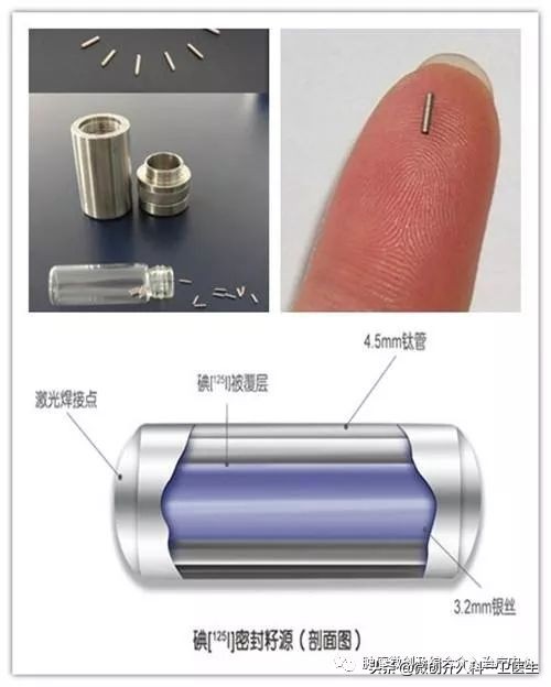 四川肿瘤医院碘125粒子植入术,肿瘤碘125粒子植入术图片