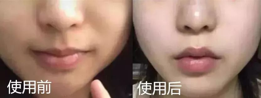 别再乱用清洁面膜了,如何正确洗脸既能白还能长痘