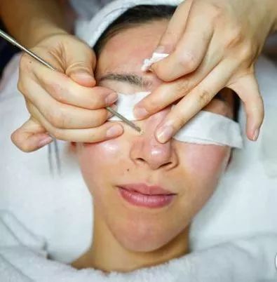 挤痘进了ICU，连下两次病危通知？这痘痘到底还能不能挤！