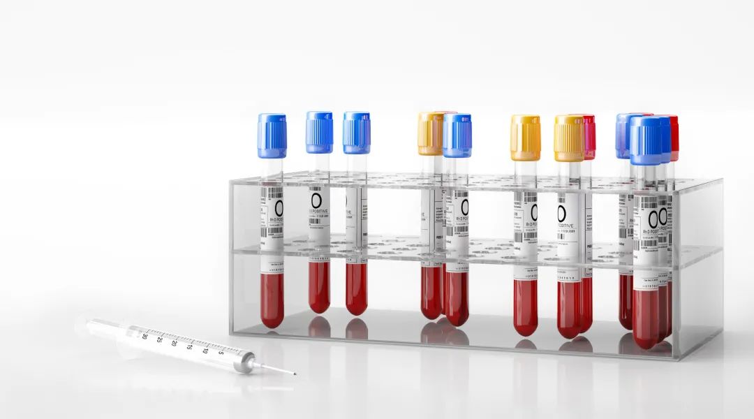 cea和ca199能查出来癌症吗,癌症检查指标ca199你了解多少
