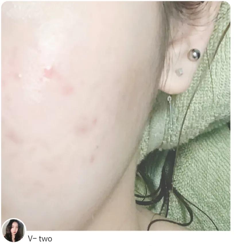 欧诗漫舒缓美白精华液测评,欧诗漫美白精华液和珀莱雅双白瓶