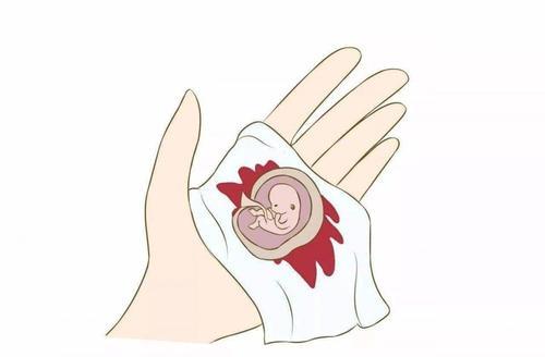 排卵障碍、子宫发育不良、处女膜闭锁女性不孕的6大原因，怎么治