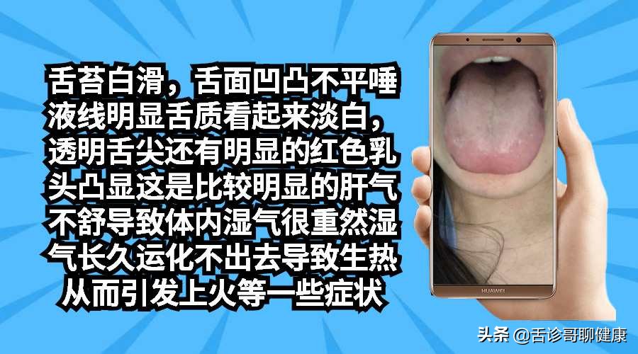 罗大伦舌诊图解肝郁气滞的舌象,抖音舌诊看体质