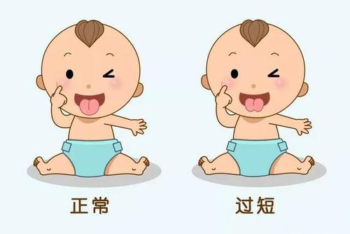 12岁孩子说话大舌头怎么办,矫正孩子大舌头的正确方法