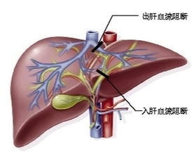 医生在手术中用烙铁止血,是真的吗?快来看看医生都有哪些*器武**