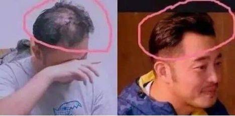 突如其来是种什么感受,突如其来是什么原因引起的