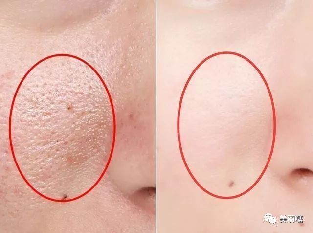 为什么微商的品牌化妆品那么便宜,微商的大牌化妆品为什么那么便宜