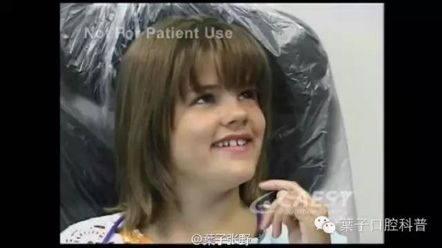 上牙龈上火突出一个鼓包,牙龈肿胀鼓包上火了吗