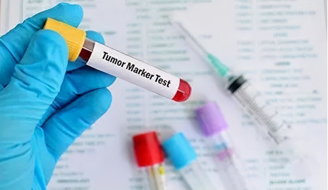 小细胞肺癌骨转移化疗有意义吗,小细胞肺癌化疗后多发骨转移