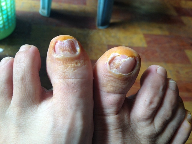 龙舟雨对广东影响,龙舟水侵袭华南