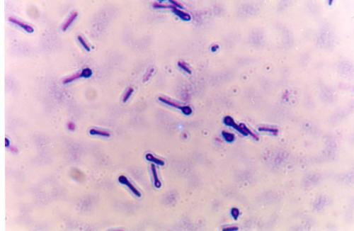 打破伤风针为什么能防止破伤风,破伤风没发作打破伤风针有用吗