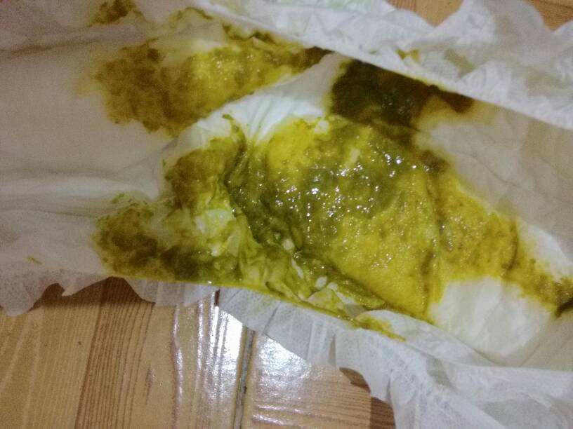 宝宝腹泻教你一招搞定,宝宝腹泻怎么才能彻底治愈