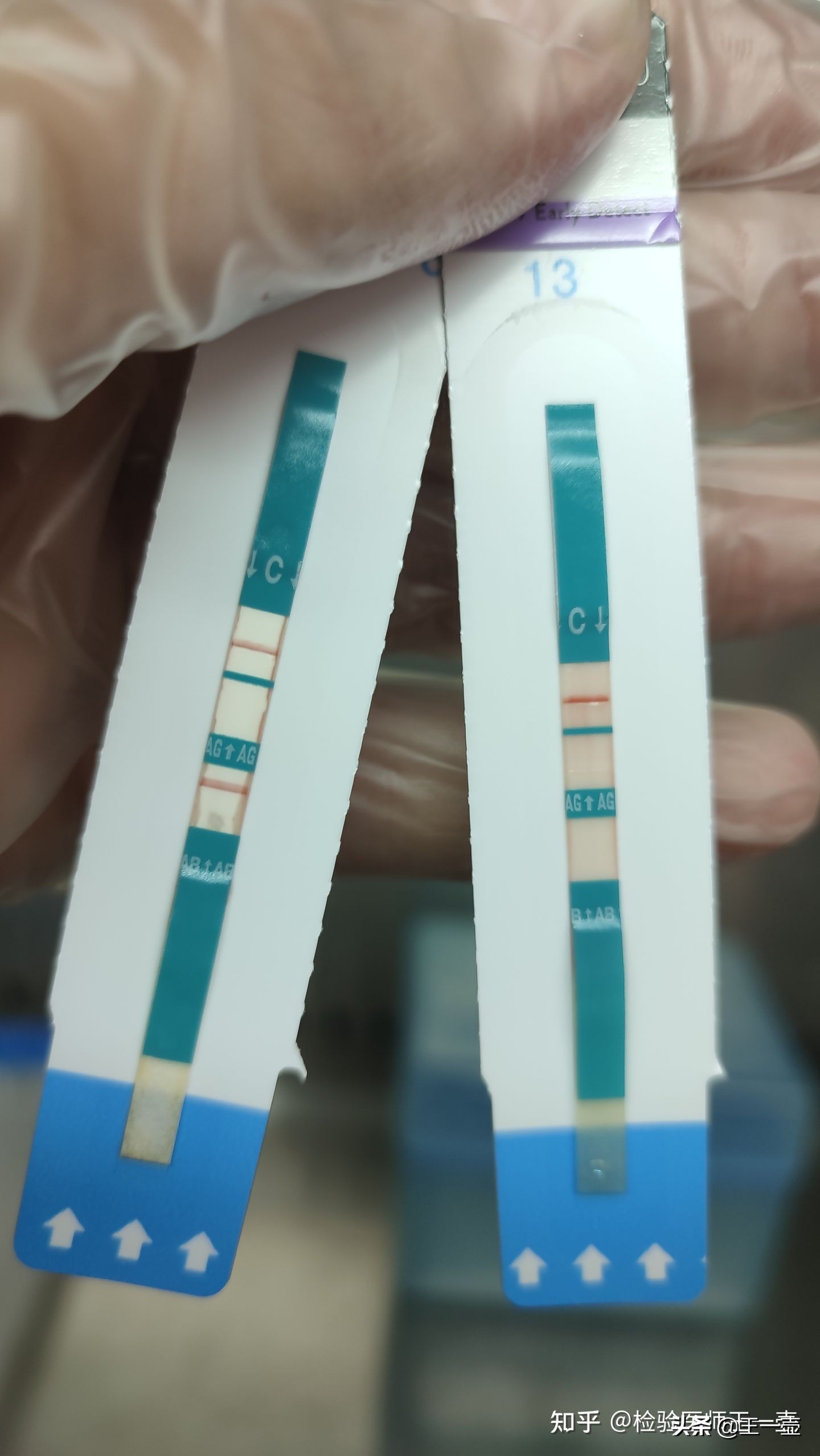 艾滋病试纸检测一滴血一滴稀释液,艾滋病检测论文