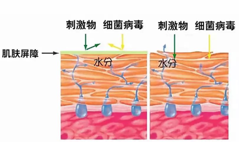 冬天面部角质层薄起皮泛红,换季敏感皮肤泛红脱皮怎么办