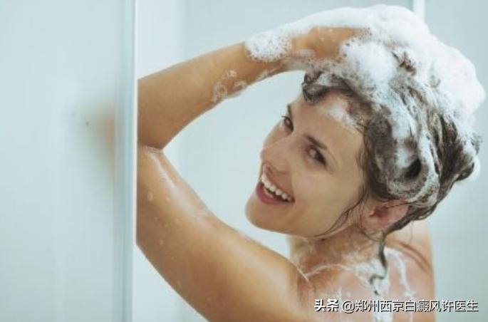 头部有白癜风可以用洗发水吗,头部有白癜风洗头注意事项