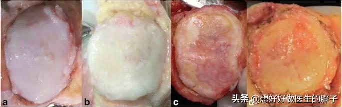 长时间骑自行车手腕疼,骑自行车膝盖上方酸痛是怎么回事