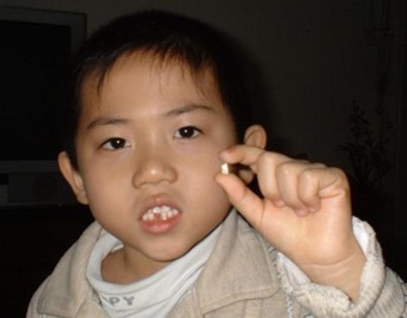 孩子换牙掉下来的牙怎么处理,孩子换牙乳牙不掉有什么好办法