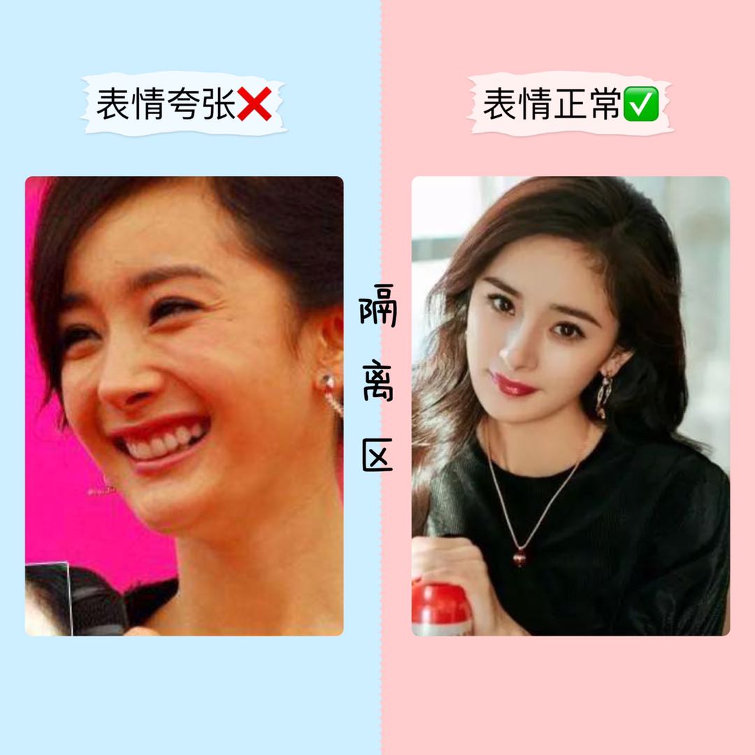 还不到30岁的郑爽，法令纹就这么明显了？*力暴**按摩，她的脸没事吧