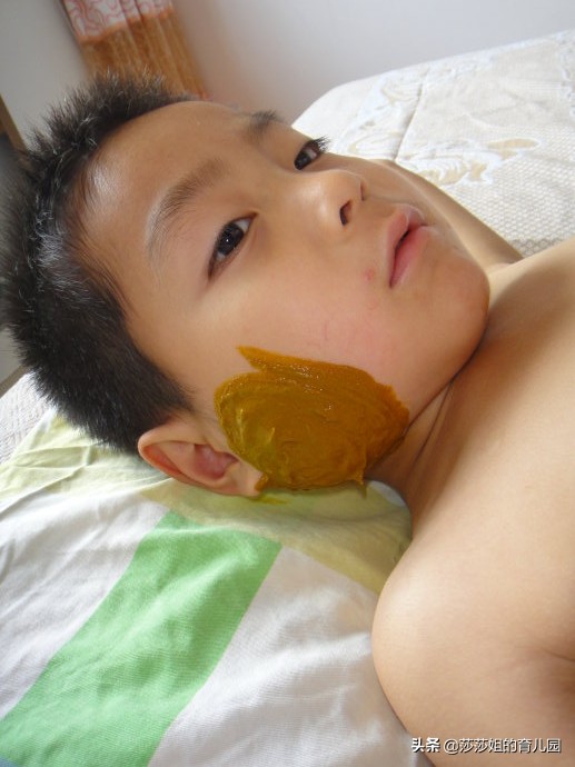 痄腮的发病规律,痄腮如何引起的