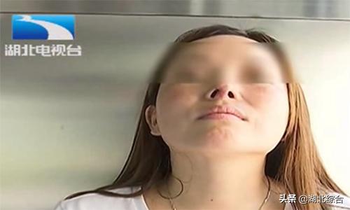 女子花三万多元隆鼻却失败,女子花5万隆鼻变畸形