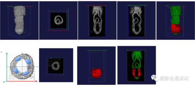 未来医疗器官可再生,再生医学给我们带来的健康