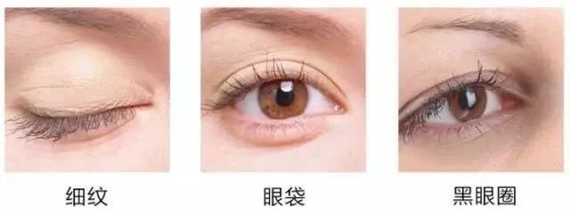 眼部周围有脂肪粒可以涂眼霜吗,眼霜涂多了会长脂肪粒吗