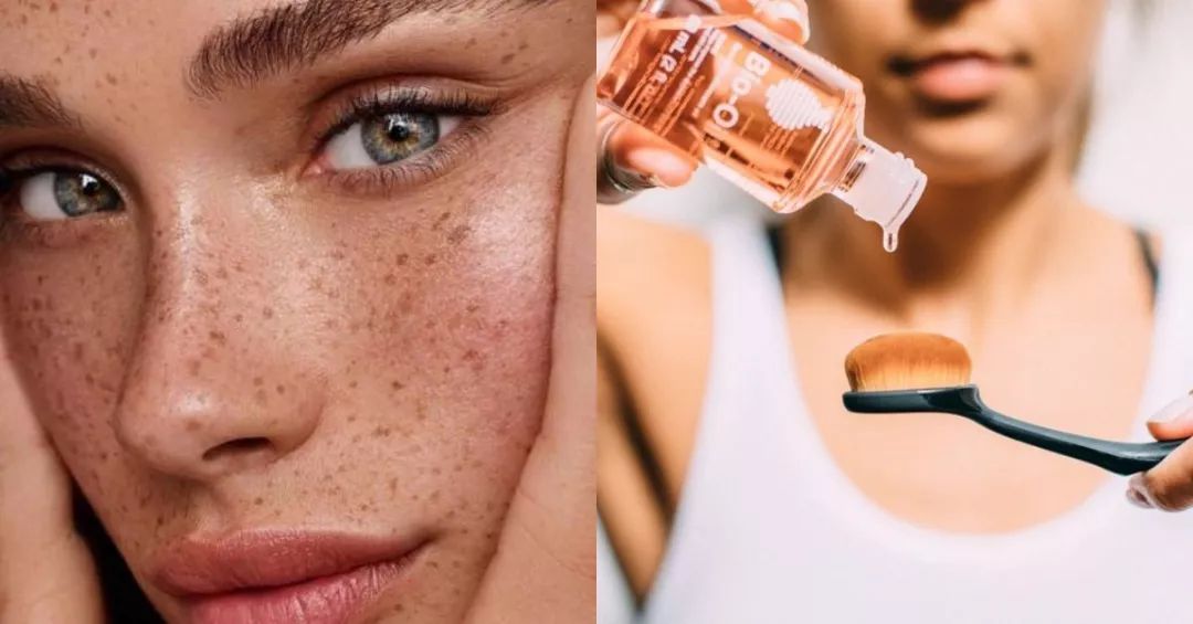 去妊娠纹的神油百洛油，竟然还有这8大用处？