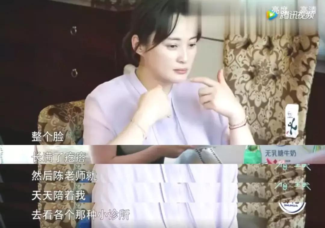 成人为什么会长痤疮,为什么成人了脸上还会长痘痘