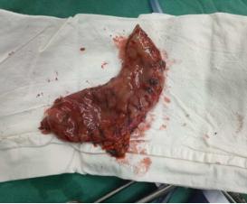 龙华区中心医院多学科协作成功救治水电解质、酸碱平衡紊乱患者