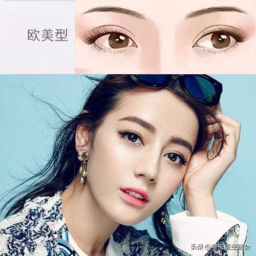 关于双眼皮你应该知道的有哪些,做双眼皮必须知道的三件事