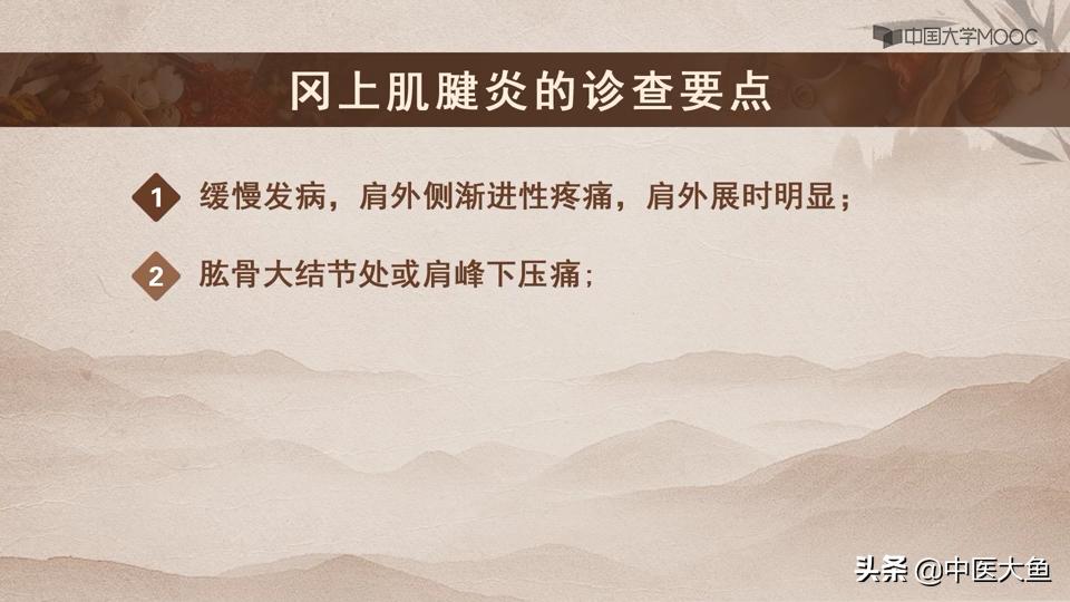 冈上肌腱炎的体征,冈上肌肌腱炎的症状及治疗