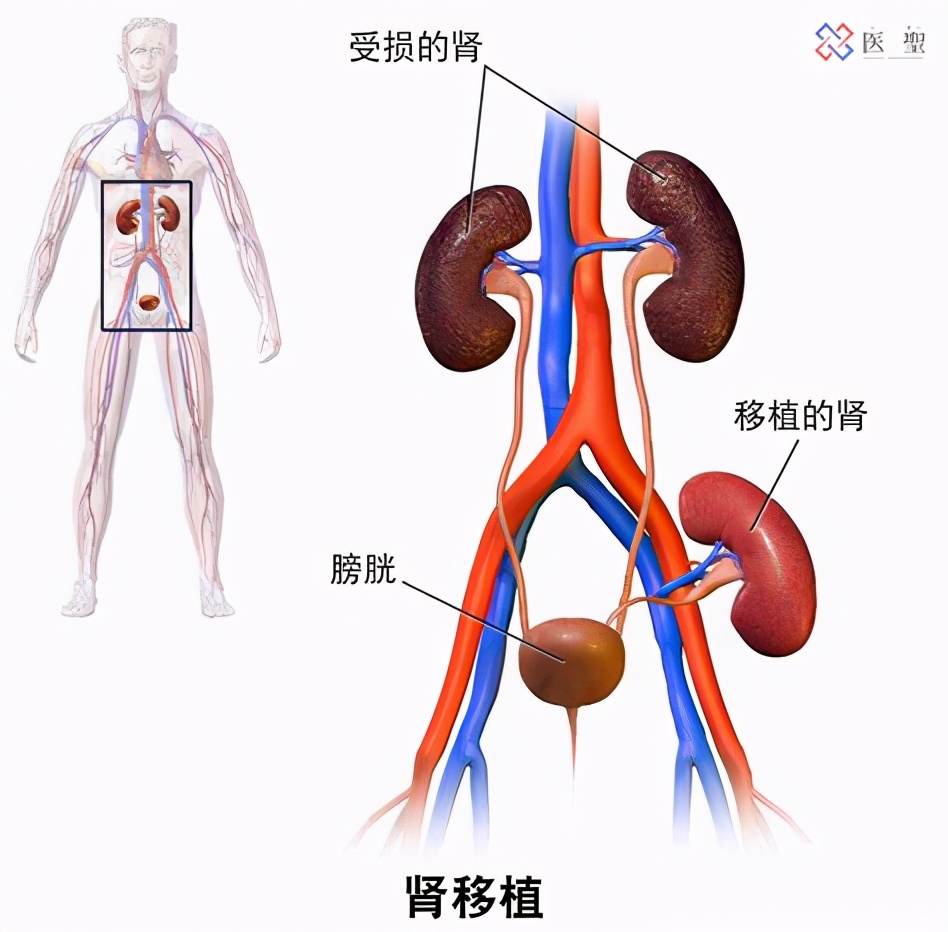 干细胞可以治疗肾功能,干细胞再生治疗肾衰竭
