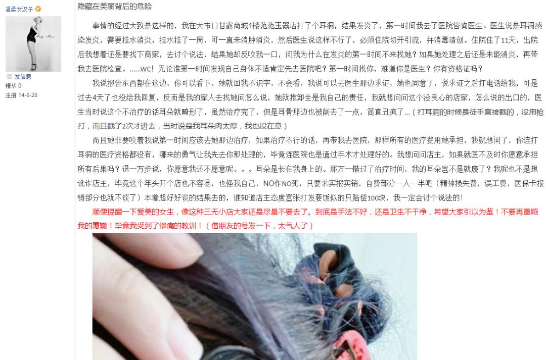 图片慎点！镇江网友打耳洞后发炎感染，耳骨被削，差点畸形