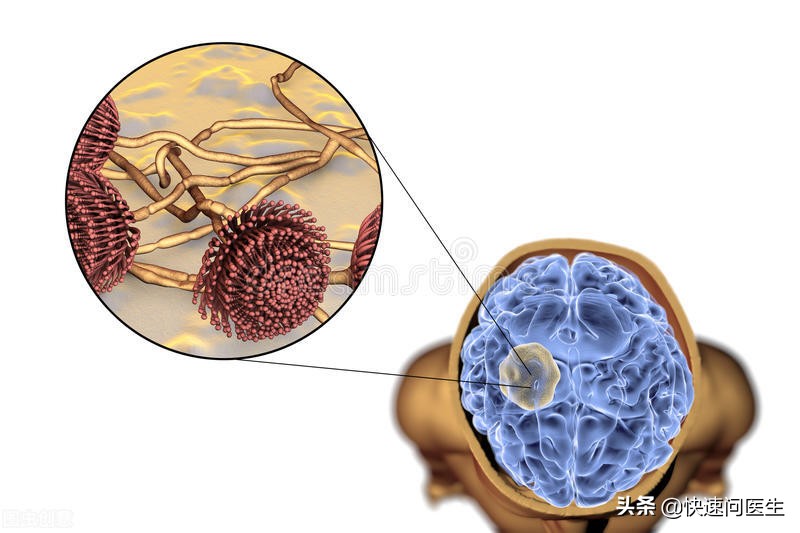 白带发黄是属于哪种妇科病,白带发黄是怎么回事怎么治疗