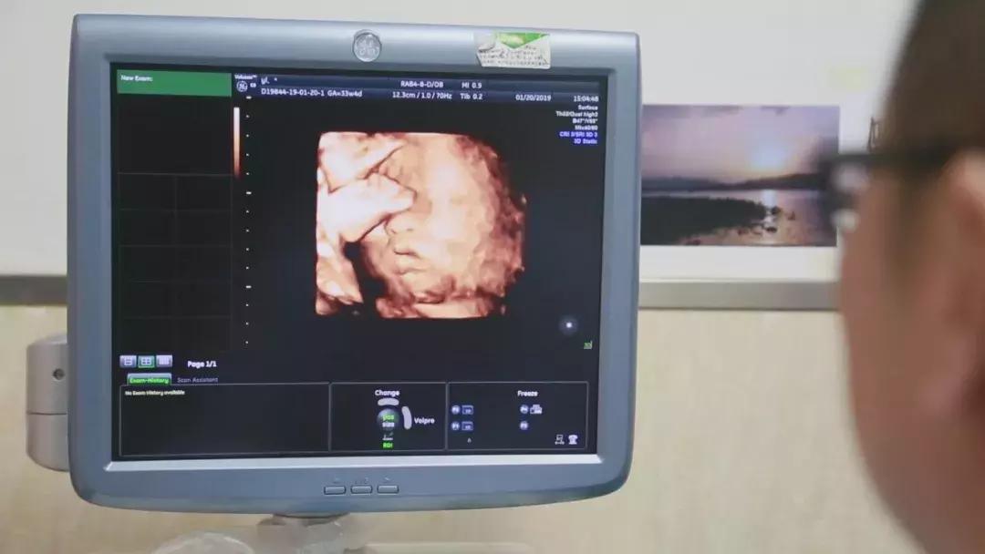 中国首例67岁自然受孕产女,女子通过试管婴儿生下一个儿子